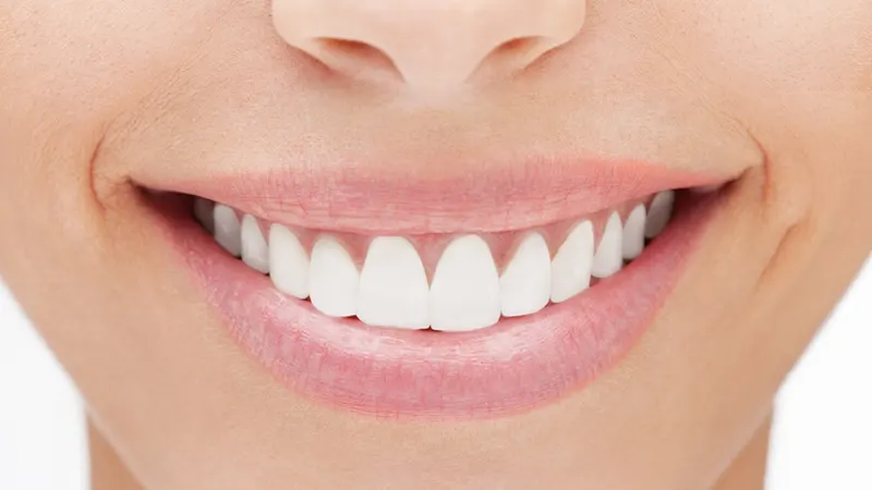 Five Secrets To Whiter Teeth