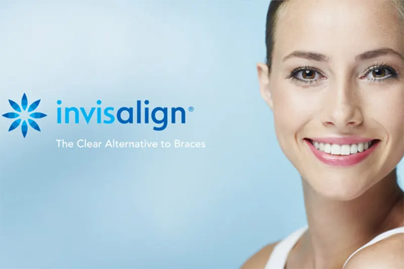 invisalign clear braces